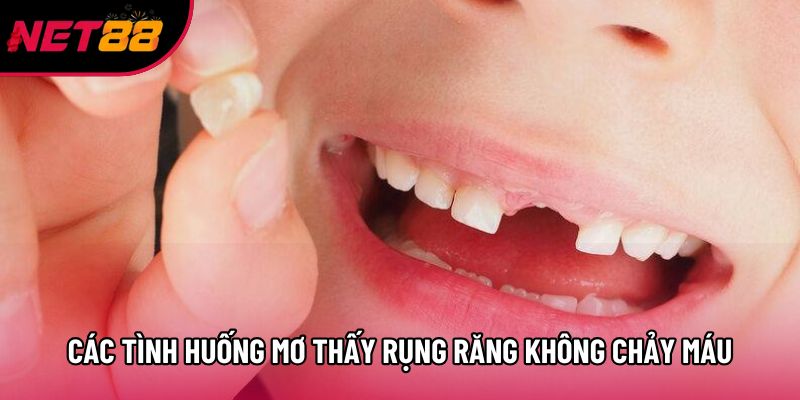 Các tình huống mơ thấy rụng răng không chảy máu hay gặp Các tình huống mơ thấy rụng răng không chảy máu hay gặp
