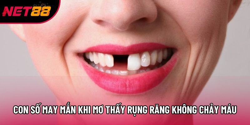 Con số may mắn khi mơ thấy rụng răng không chảy máu Con số may mắn khi mơ thấy rụng răng không chảy máu