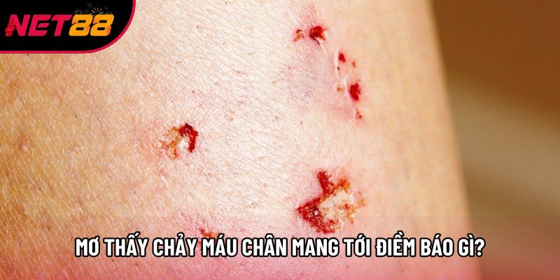 Mơ thấy chảy máu chân mang tới điềm báo gì? Mơ thấy chảy máu chân mang tới điềm báo gì?