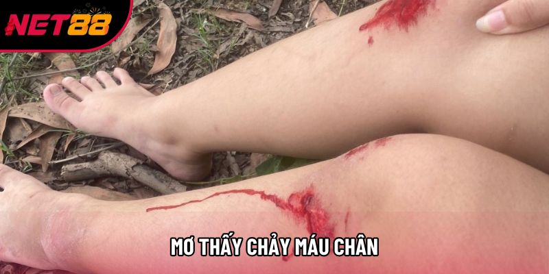Mơ Thấy Chảy Máu Chân Mang Tới Điềm Báo Gì Cho Vận Mệnh?